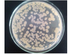 GB 4789.2-2016 食品安全国家标准 食品微生物学检验 菌落总数测定 检测标准