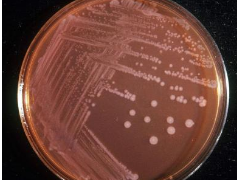 GB 4789.4-2016 食品安全国家标准 食品微生物学检验 沙门氏菌检验 检测标准