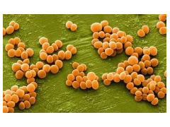 GB 4789.10-2016 食品安全国家标准 食品微生物学检验 金黄色葡萄球菌检验 检测标准