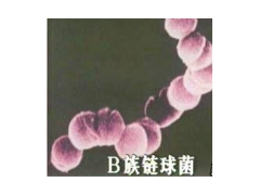 GB 4789.11-2014 食品安全国家标准 食品微生物学检验 β型溶血性链球菌检验 检测标准