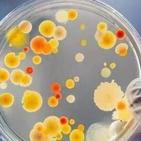 青岛市食品菌落总数检测机构，菌落总数质检报告到哪里